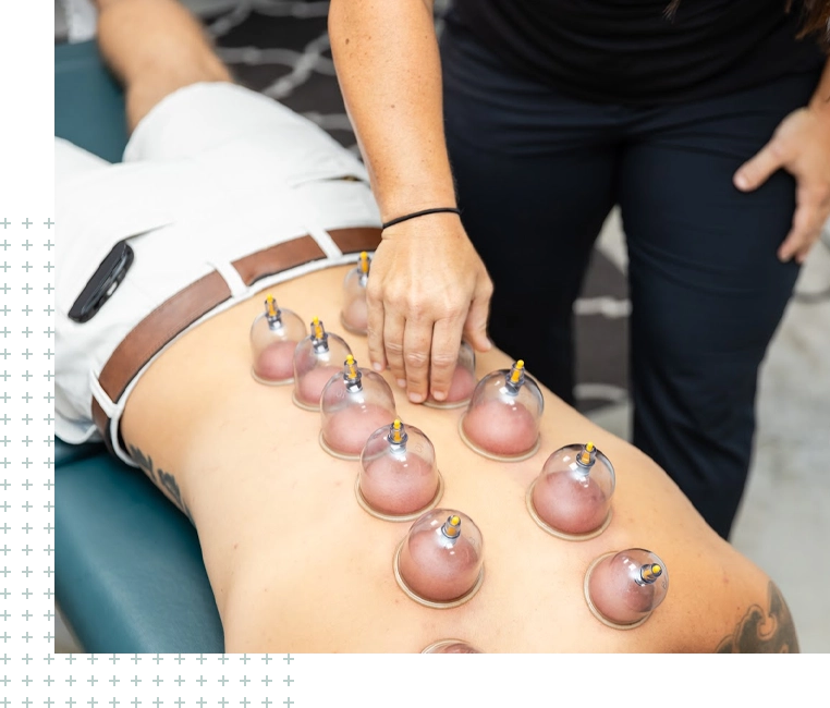 A person is getting their back turned to receive an acupuncture treatment.